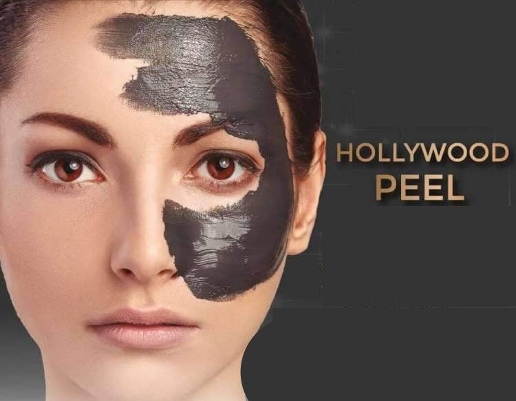 Hollywood Peel(Carbon Facial)